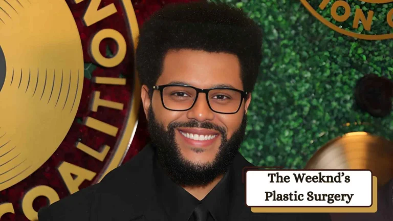 The Weeknd Plastic Surgery